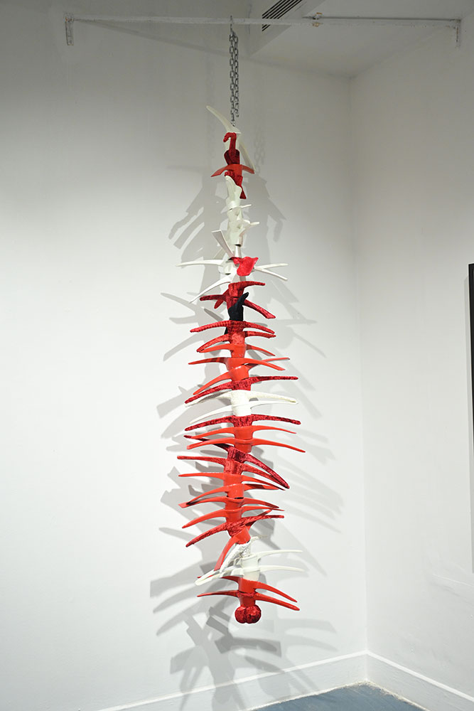 <Non-Spinal-10 , 2025